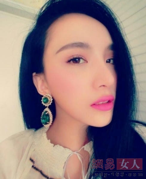 做隆胸手术死亡 细数整容失败女星最惨丧命