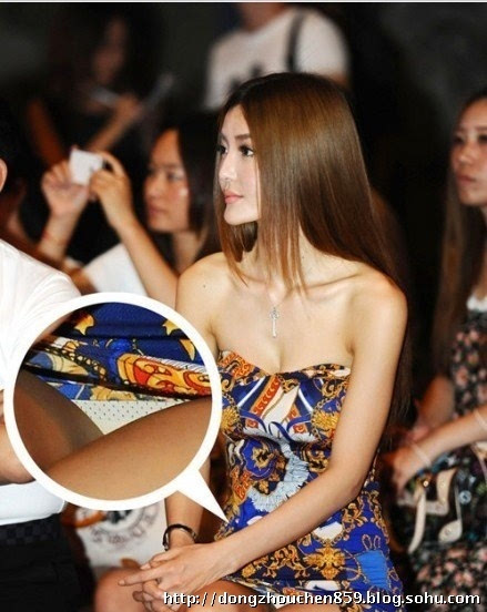 做隆胸手术死亡 细数整容失败女星最惨丧命