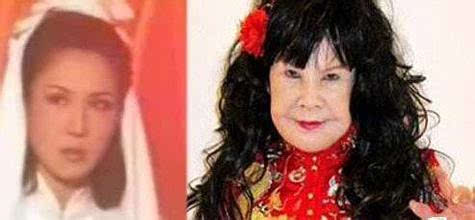 做隆胸手术死亡 细数整容失败女星最惨丧命