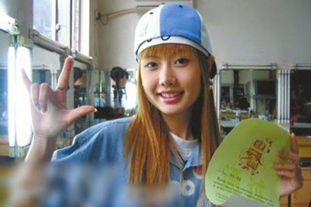 做隆胸手术死亡 细数整容失败女星最惨丧命