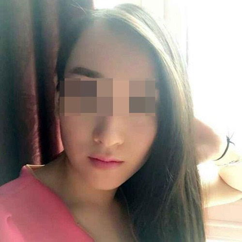 做隆胸手术死亡 细数整容失败女星最惨丧命