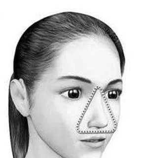 广报晨汇丨广州女孩挤了几个黑头,一度生命垂危!“死亡三角区”不能乱碰是真的!