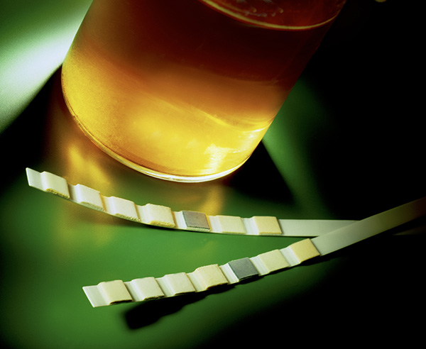 被尿憋醒太忧伤,专家:“尿”色反映健康状况