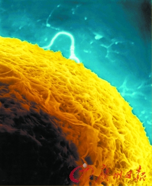 张秀兰:“我是违规救人”