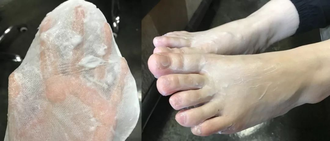 这个让脚层层脱皮的足膜,一边忍着恶心一边用