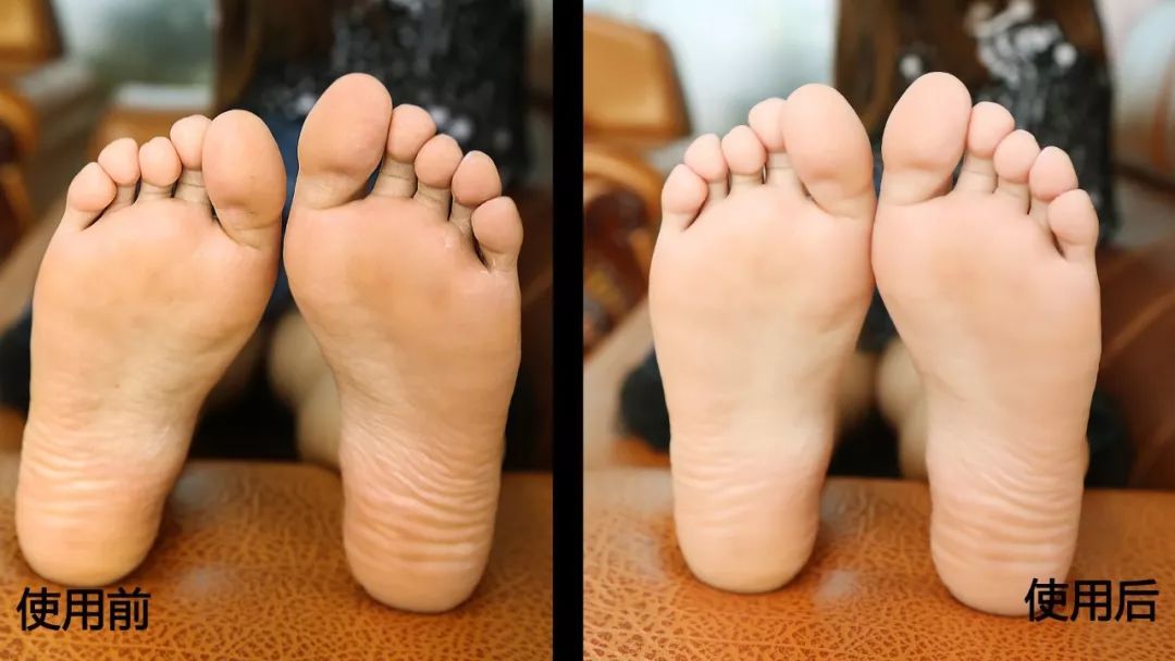 这个让脚层层脱皮的足膜,一边忍着恶心一边用