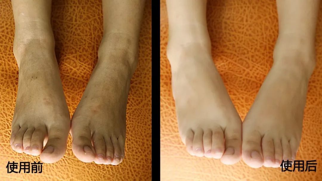 这个让脚层层脱皮的足膜,一边忍着恶心一边用