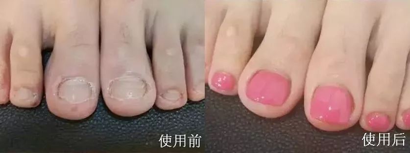 这个让脚层层脱皮的足膜,一边忍着恶心一边用