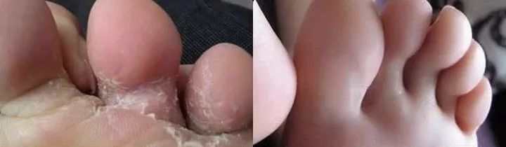 这个让脚层层脱皮的足膜,一边忍着恶心一边用