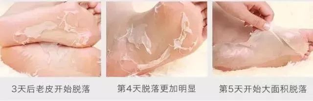这个让脚层层脱皮的足膜,一边忍着恶心一边用