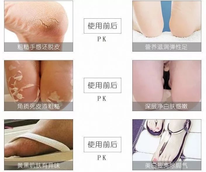 这个让脚层层脱皮的足膜,一边忍着恶心一边用