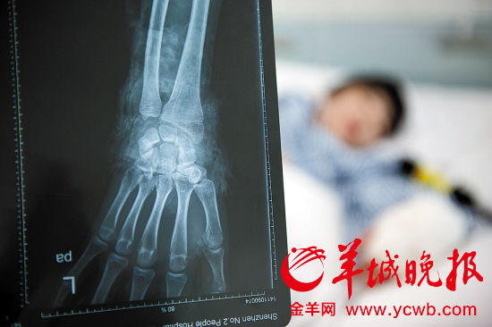 深圳一男子说别人逗比被砍断手筋和骨头(图)