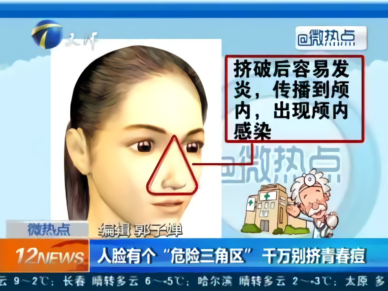 女子挤痘痘被送进ICU，大小便都失禁了，请注意面部危险三角区