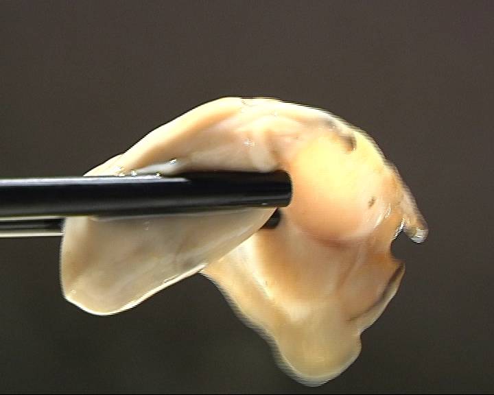 初冬时节 吃生蚝米线补补“蛎”量