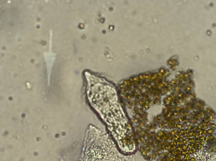 显微镜下的血吸虫