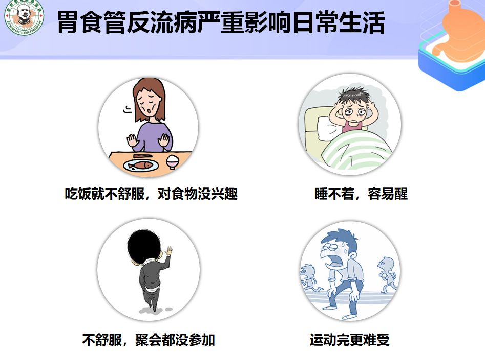 反酸烧心、打嗝、咳嗽、哮喘,可能是胃食管反流作怪!