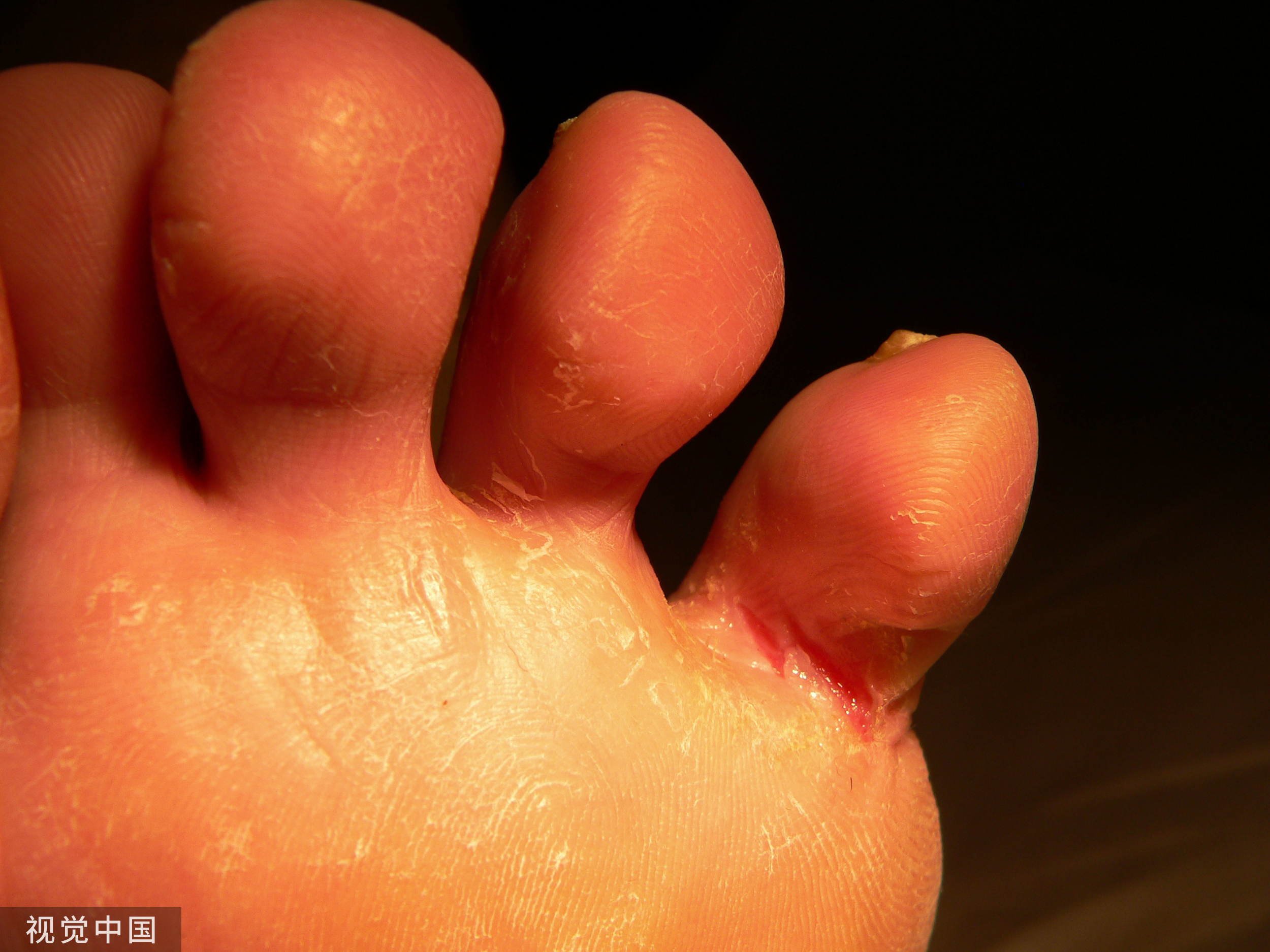 中国人为什么不混洗袜子和内裤