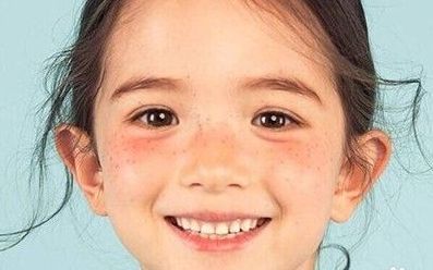 兰州祛斑美白使用说明