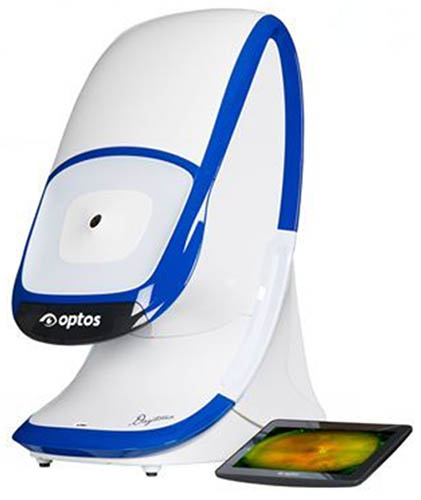 欧堡超广角眼底照相仪入驻重庆爱尔眼科医院