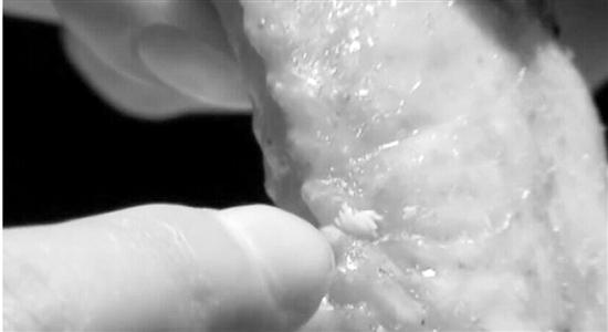 囧!肯德基吃出苍蝇卵!白白的米粒状物体,看着像蛆虫(组图)