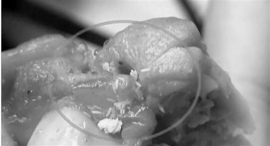 囧!肯德基吃出苍蝇卵!白白的米粒状物体,看着像蛆虫(组图)