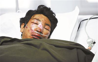 4月18日，雪崩幸存者Dawa Tashi Sherpa在接受救治