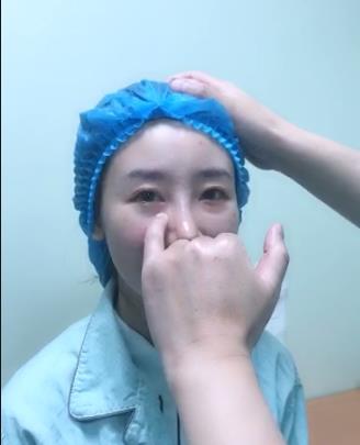 连化妆磨皮都没办法遮住的眼袋 小编这次终于把它除掉了