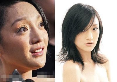 对于祛痘,周迅拥有丰富的祛痘经验,造型师推荐了一款天然的法国欧泉琳祛痘产品htt