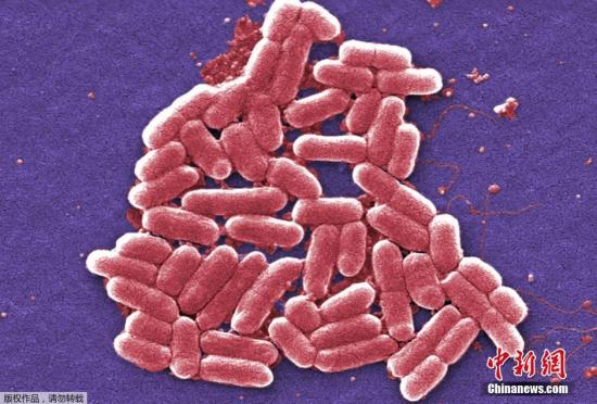 图为显微镜下携带mcr-1基因的大肠杆菌。这种“超级细菌”是在宾夕法尼亚州一名49岁女性的尿液中发现的，这名女性在之前的5个月内没有外出旅行史。美国微生物学会刊物《抗菌剂与化疗》称：“这表明出现了真正的泛耐药细菌。”