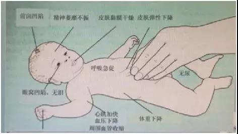 2018年第一批执业护士《专业实务》考试真题及答案(网友版3)