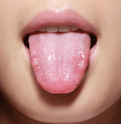 男女养生须知：舌头上有这种纹路竟是短命先兆