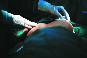 上海威宁引爆隆胸炸弹:硅凝胶植入体不合格登黑榜