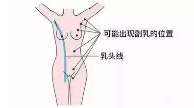 瑜伽6个动作巧妙去除副乳，还你天生美丽