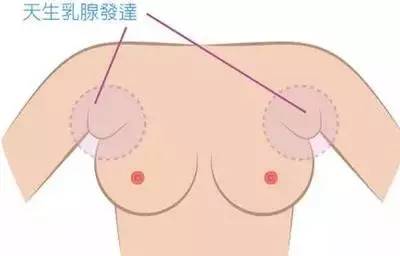 瑜伽6个动作巧妙去除副乳，还你天生美丽
