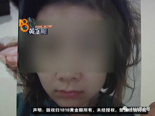 女子隆胸没达效果和丈夫离婚：摸起来没感觉了