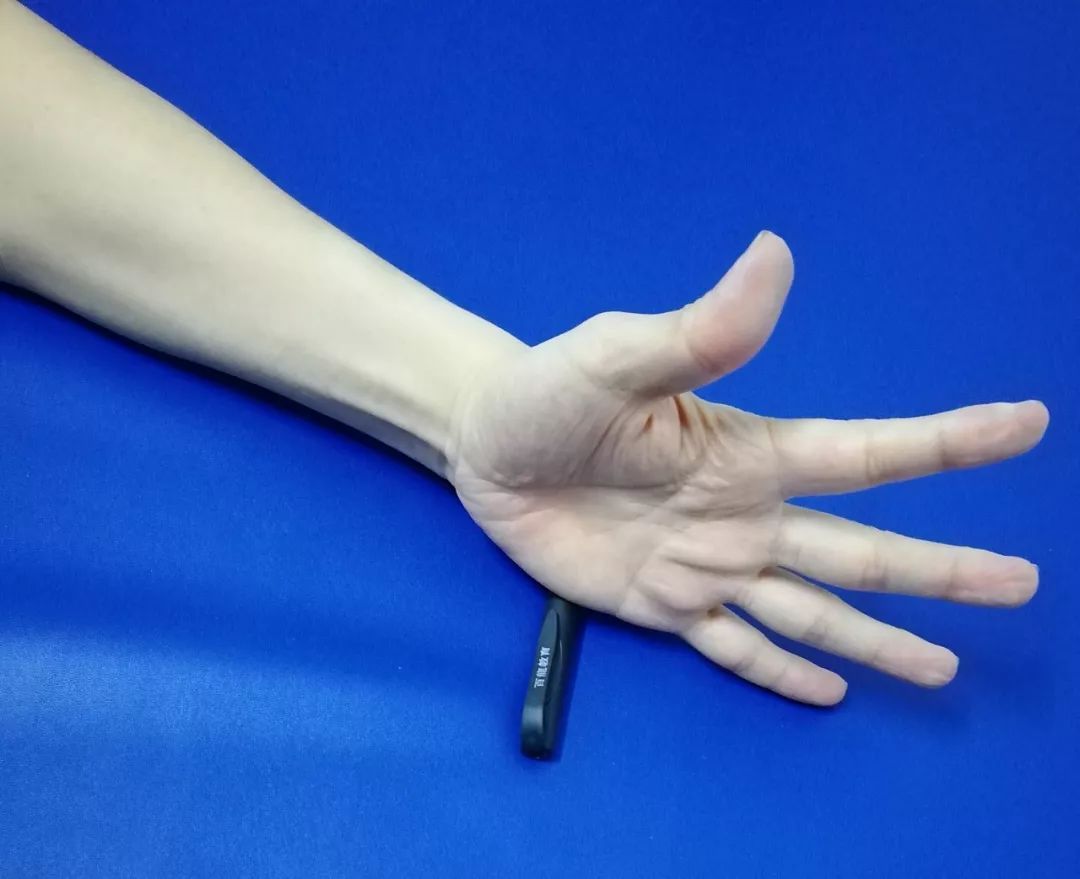 偏瘫患者打开手指难？简单易学的5个动作，你必须要会！