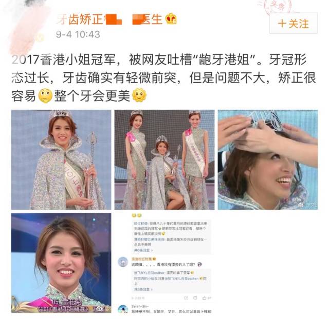 2017港姐冠军是个龅牙妹,大嘴塞得进后冠,真心怀念蔡少芬袁咏仪胡