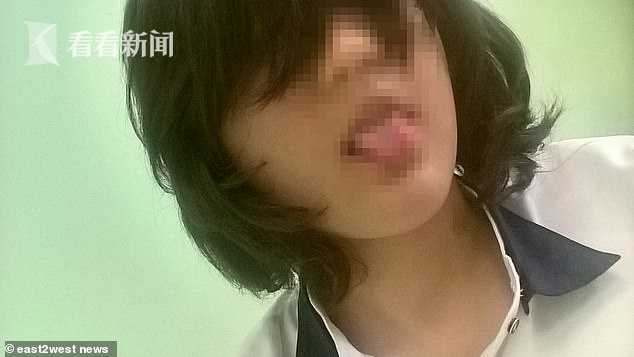 俄12岁女孩吃人肉免刑罚 和同学详述味道引抗议