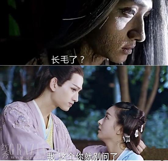 是时候寻找去除毛发神器了