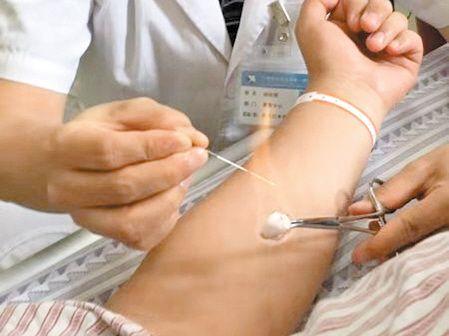 毫火针为中风后康复助力