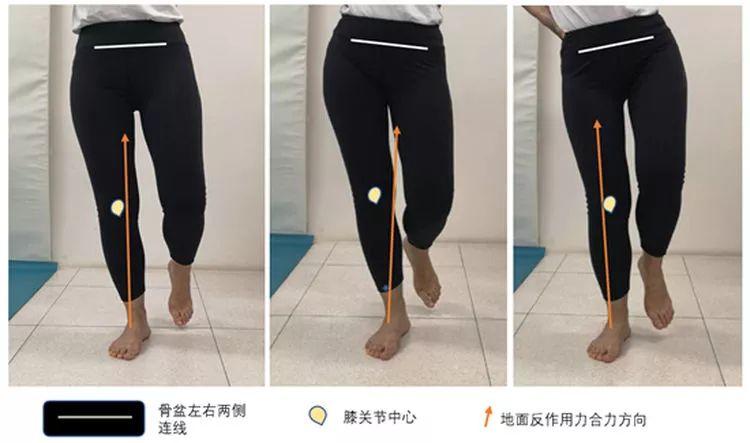 还在每天坚持走1万步?这些隐患你可能不知道→